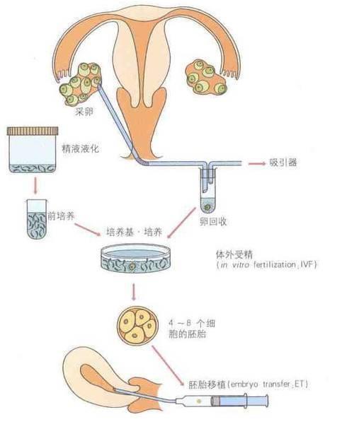 做供卵试管有哪些步骤_供卵试管步骤详解