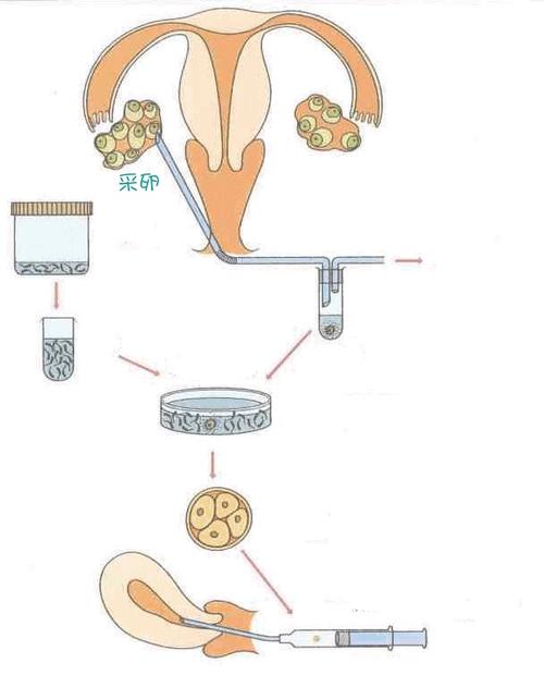 国内在哪里做供卵比较好【国内哪里做供卵比较好?】