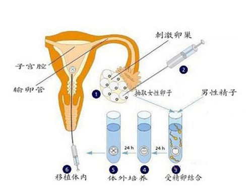 如何接受供卵【接受供卵的正确方式】